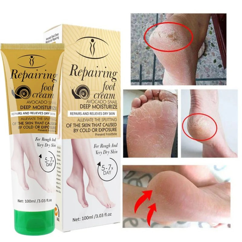 Aichun Beauty Repairing Foot Cream